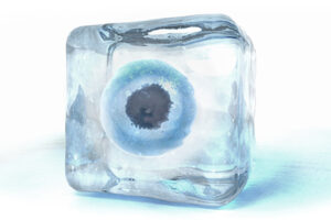 Egg Freezing