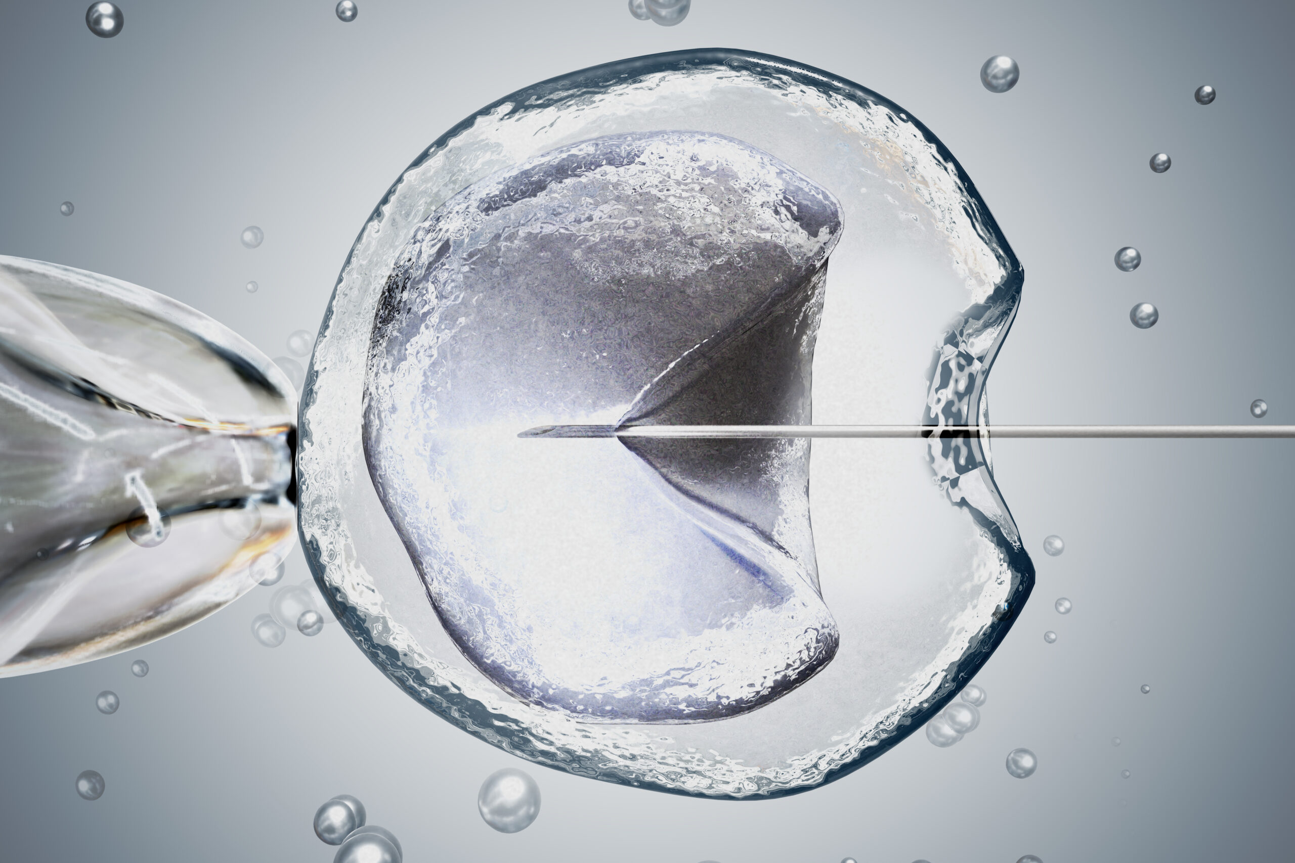 IVF